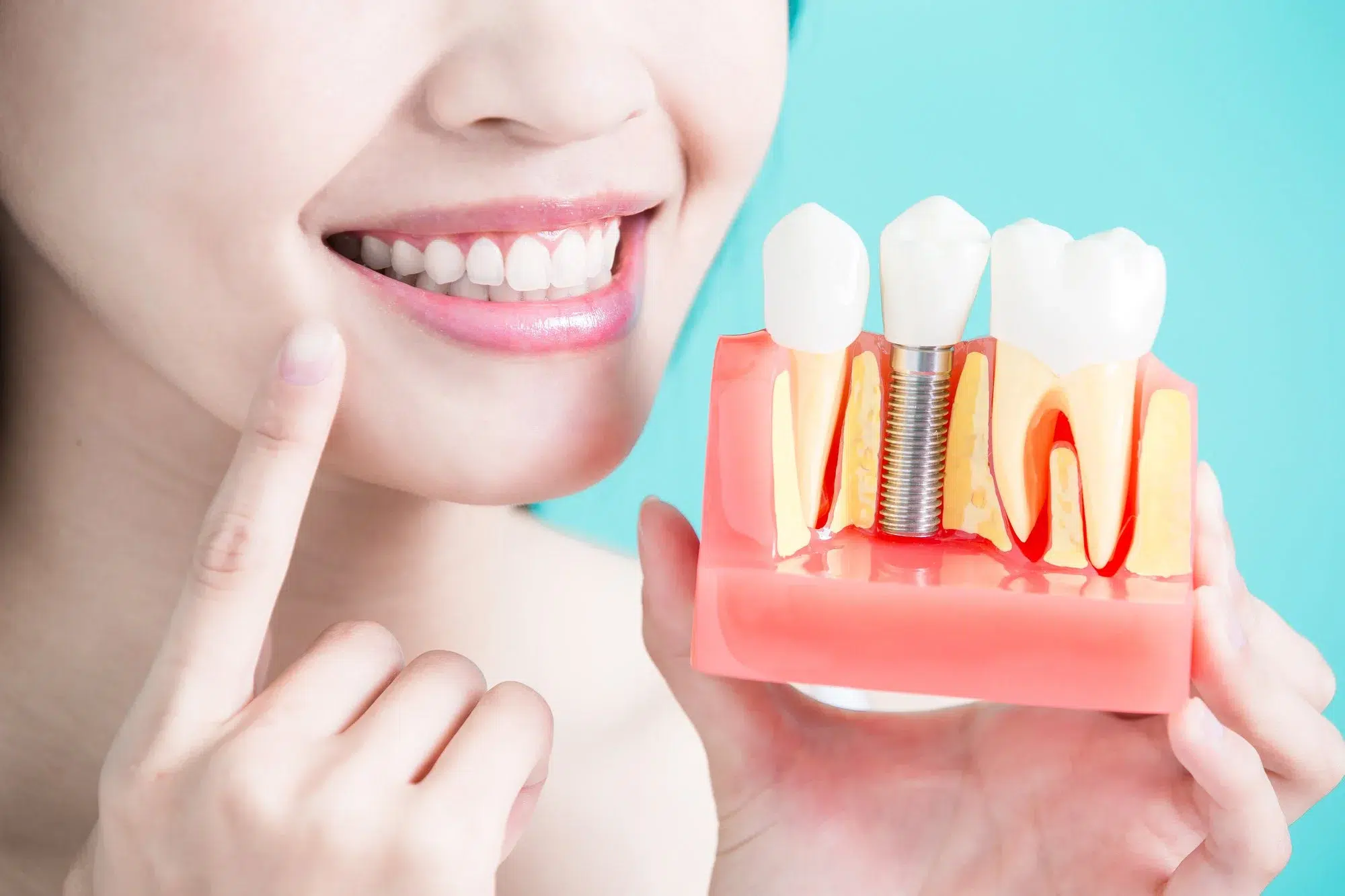 Do dental implants hurt