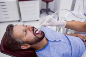 How Much Is Composite Bonding Per Tooth in UK