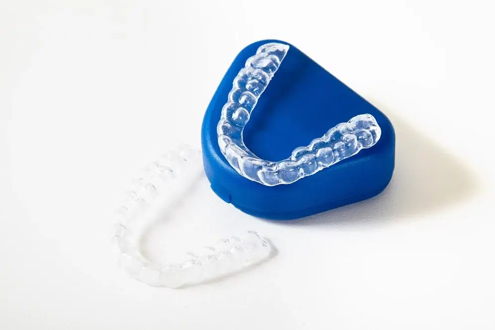 Aligner Trays