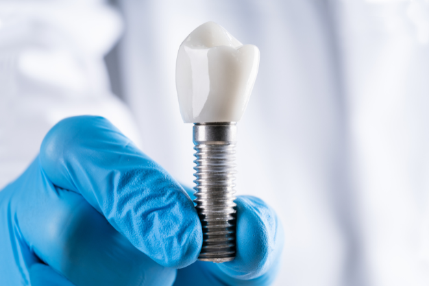 Selecting the Most Suitable Type of Dental Implant