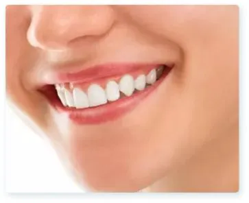 enhance your smile with composite bonding