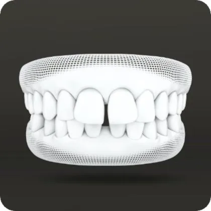 gaps between teeth