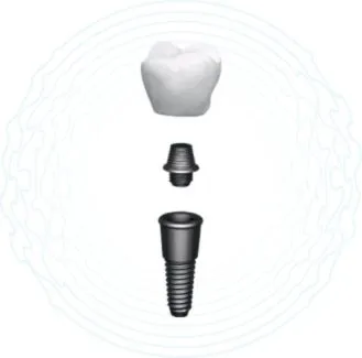 restore your smile with dental implants