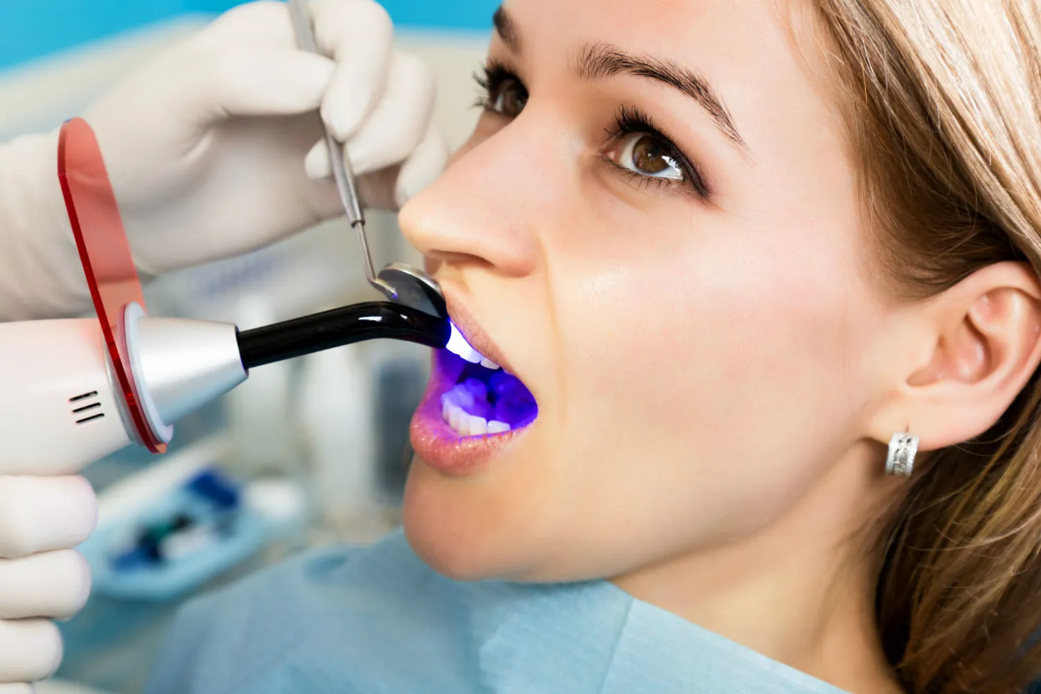 The Composite Bonding Removal Process