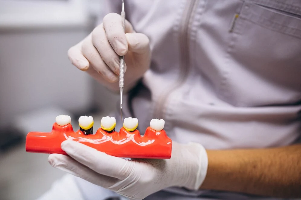 The Manufacturing Process of Dental Implants