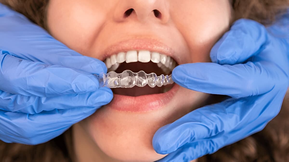 invisalign cost scotland