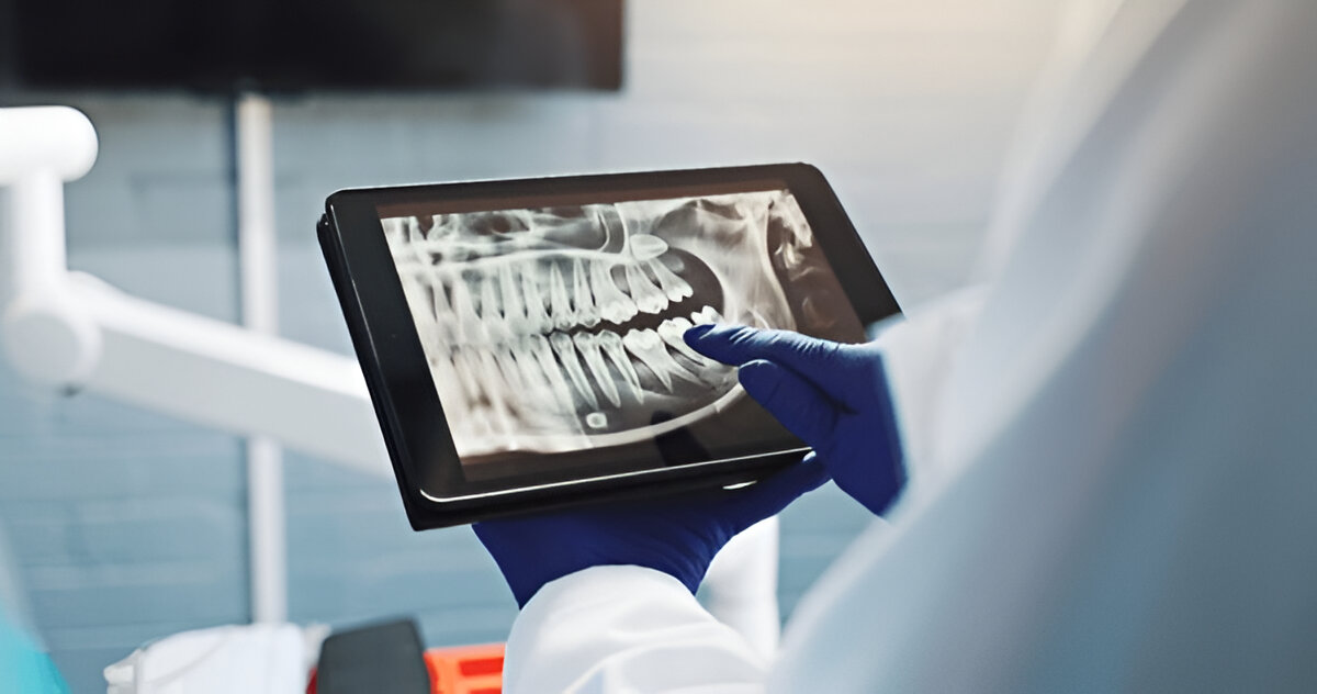 digital smile design