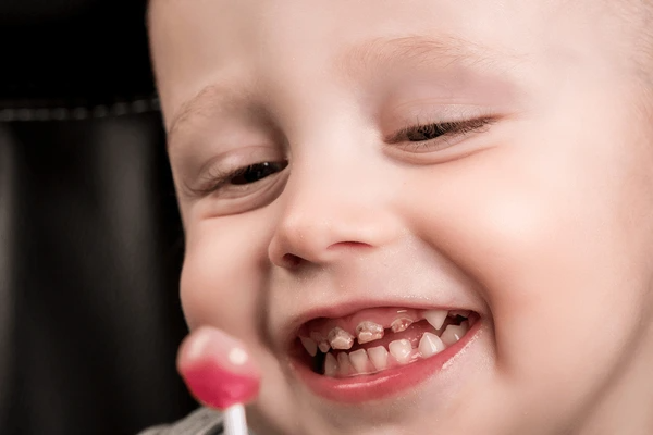 habits that damage children's teeth