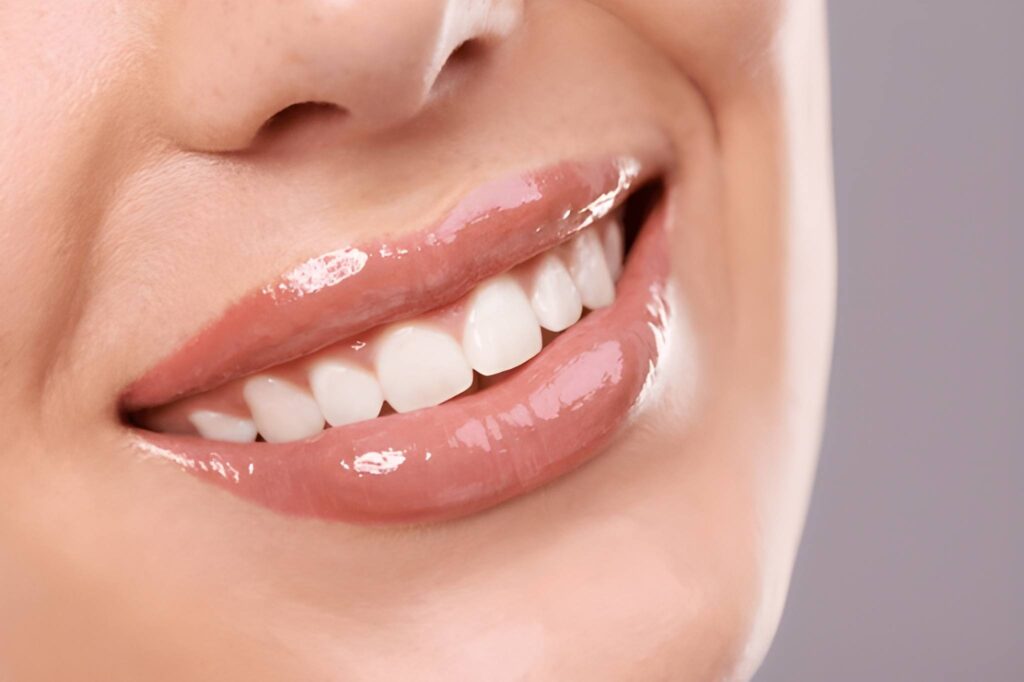 psychology of smiling after cosmetic dentistry