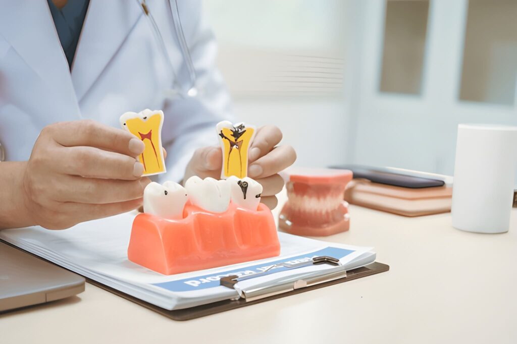 sugar and tooth decay