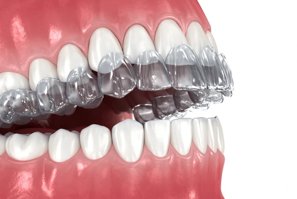 common invisalign problems