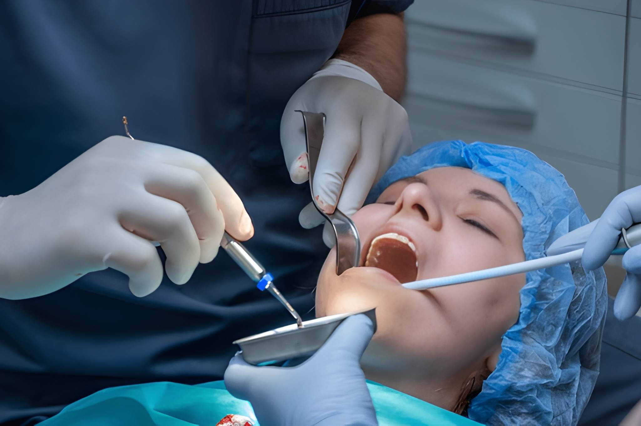 bone graft for dental implant